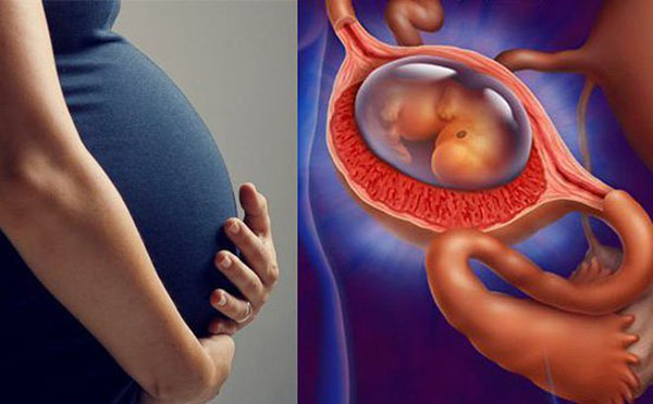 Bệnh mang thai ngoài tử cung