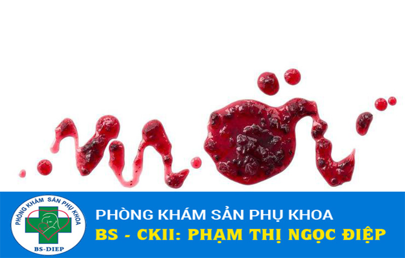 dấu hiệu sảy thai sớm khi chưa vào tử cung