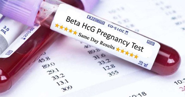 Chỉ số HCG thai ngoài tử cung