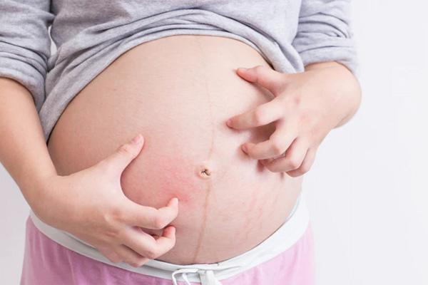 Mẹ bầu bị ngứa toàn thân