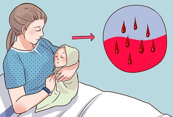 sau-sinh-mo-co-kinh-som Sau sinh có kinh sớm