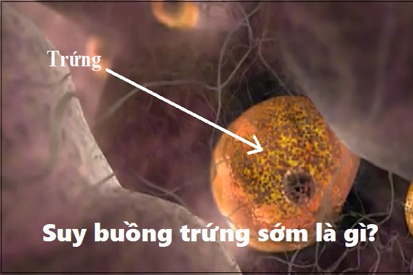 suy-buong-trung-som Suy buồng trứng sớm