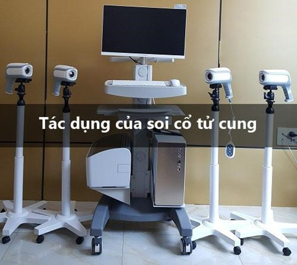 tac-dung-cua-soi-tucung Tác dụng của soi cổ tử cung