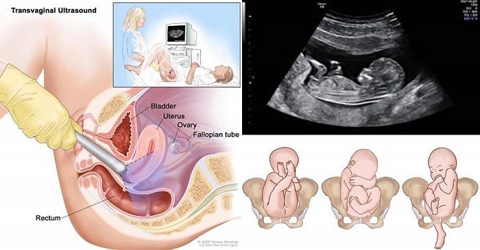 Siêu âm thai 12 tuần giúp bạn dễ dàng quan sát được đó là các bộ phận của bé đang phát triển như thế nào. Hãy đón xem những hình ảnh đáng yêu và kỳ diệu của đứa bé trong bụng mẹ.