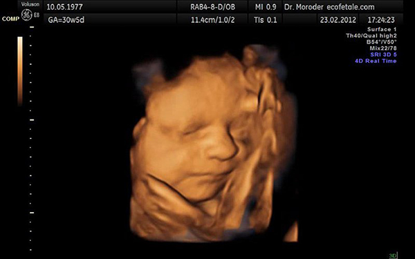 Khi thai nhi đang ở tuần 21, siêu âm 4D là một trải nghiệm tuyệt vời cho mẹ bầu. Với khả năng quan sát được rõ hơn về khuôn mặt và đường nét của con, bạn sẽ cảm thấy kết nối mạnh mẽ hơn với con yêu. Đặc biệt, siêu âm 4D và các chỉ số siêu âm sẽ cung cấp những thông tin hữu ích về sức khỏe của thai nhi.