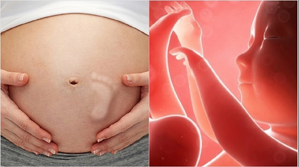 “Thai máy là gì?” là thắc mắc chung của những mẹ bầu mang thai con đầu lòng