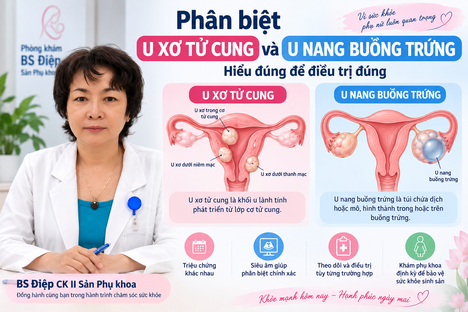Phân biệt u xơ tử cung và u nang buồng trứng – BS Điệp