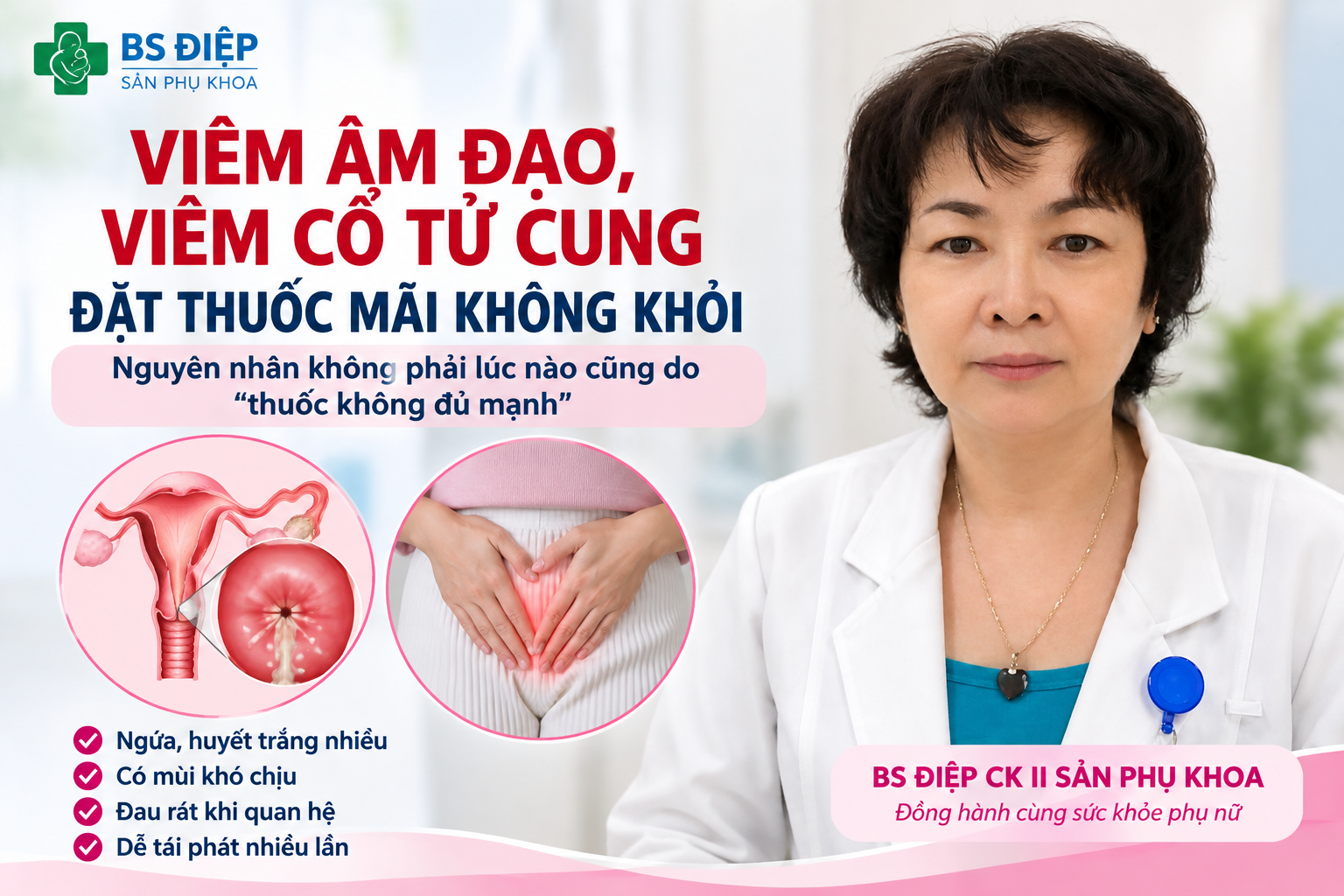 Viêm âm đạo đặt thuốc không khỏi – BS Điệp