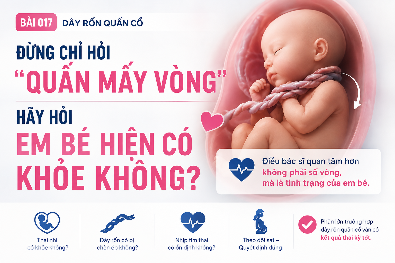 Dây rốn quấn cổ - theo dõi sức khỏe thai nhi