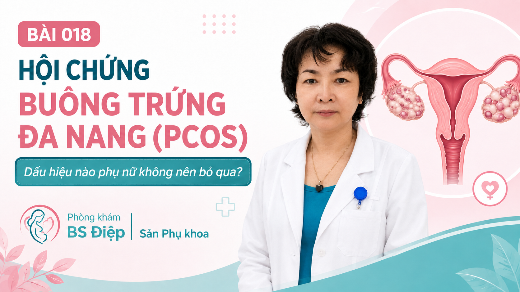 Hội chứng buồng trứng đa nang ở phụ nữ