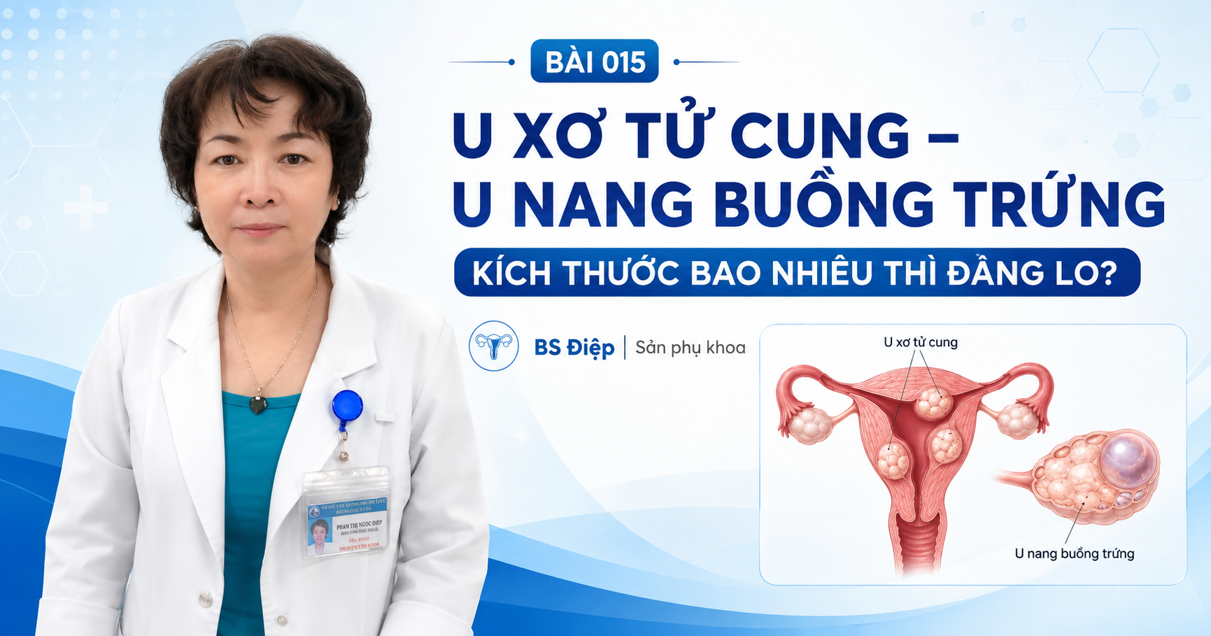 U xơ tử cung, u nang buồng trứng bao nhiêu thì đáng lo? Không chỉ kích thước, bác sĩ còn đánh giá vị trí, triệu chứng, hình ảnh siêu âm. 