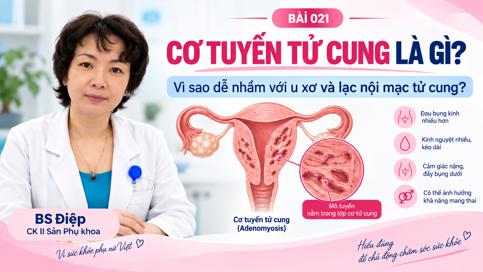 Cơ tuyến tử cung là gì ? Khác u xơ, lạc nội mạc tử cung